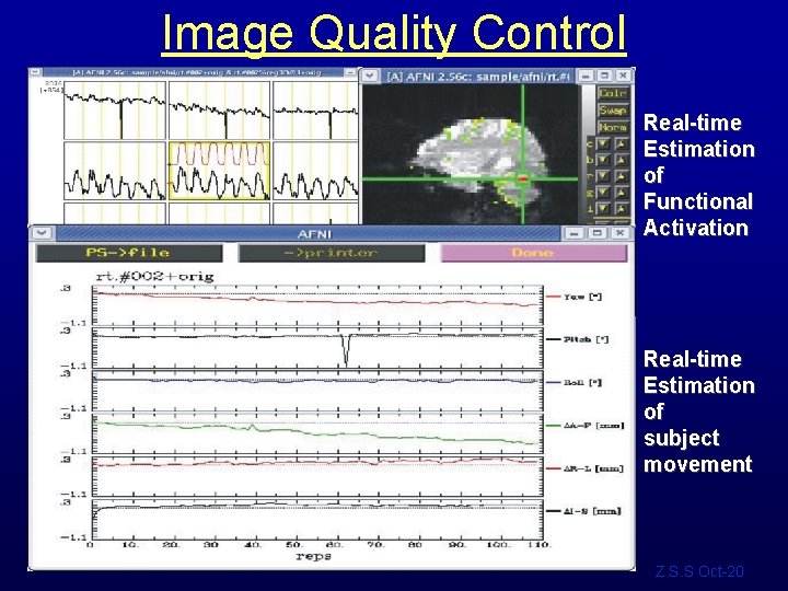 Image Quality Control Real-time Estimation of Functional Activation Real-time Estimation of subject movement Z.