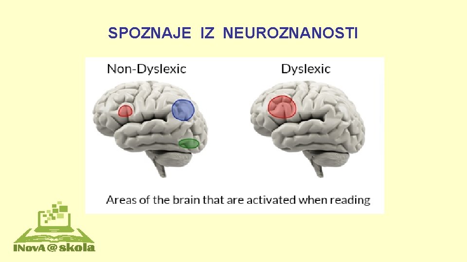 SPOZNAJE IZ NEUROZNANOSTI 