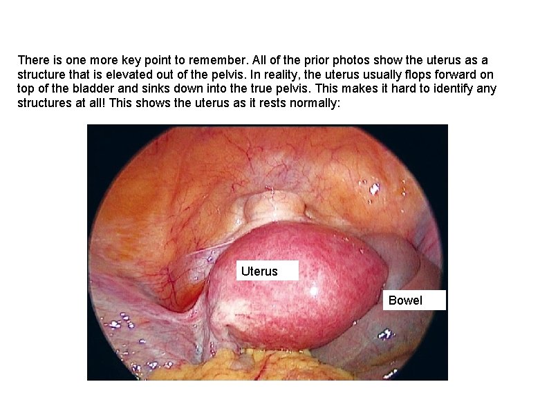 There is one more key point to remember. All of the prior photos show