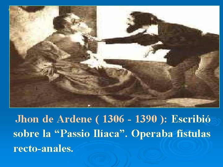 Edad Media Jhon de Ardene ( 1306 - 1390 ): Escribió sobre la “Passio
