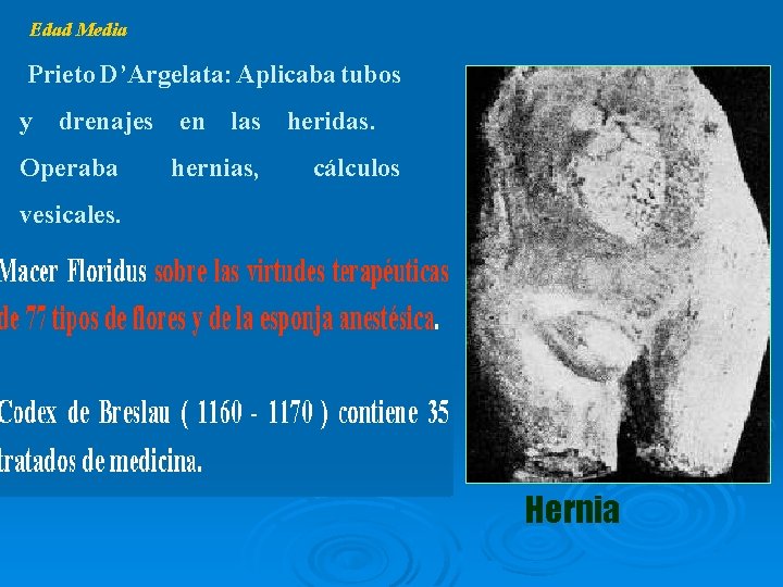 Edad Media Prieto D’Argelata: Aplicaba tubos y drenajes en las heridas. Operaba hernias, cálculos