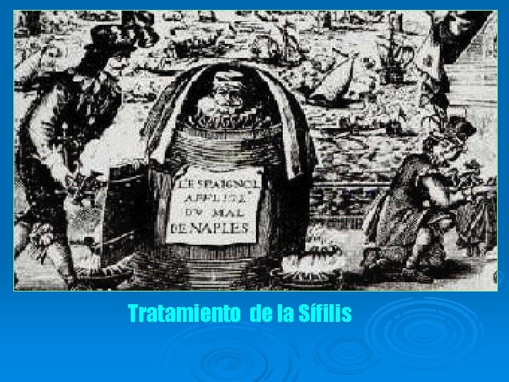 Tratamiento de la Sífilis 