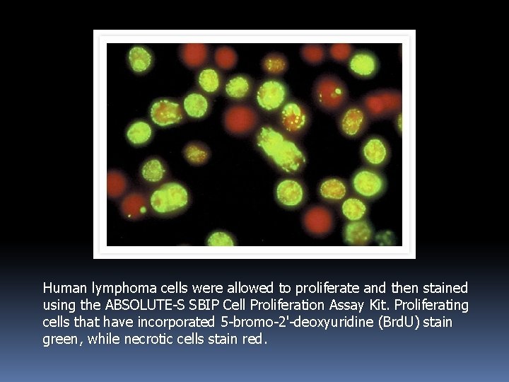 Human lymphoma cells were allowed to proliferate and then stained using the ABSOLUTE-S SBIP