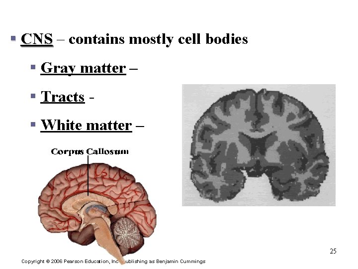 Vocab: CNS § CNS – contains mostly cell bodies § Gray matter – §