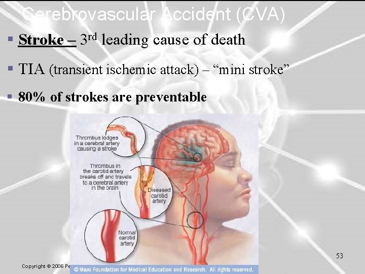 Cerebrovascular Accident (CVA) § Stroke – 3 rd leading cause of death § TIA
