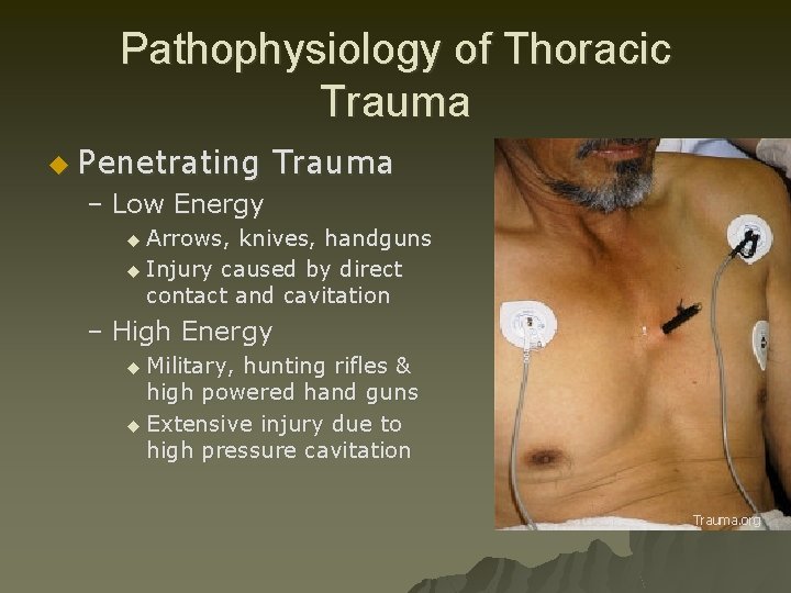 Pathophysiology of Thoracic Trauma u Penetrating Trauma – Low Energy u Arrows, knives, handguns