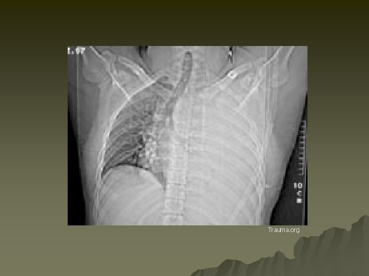 Trauma. org 