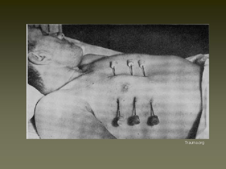 Trauma. org 