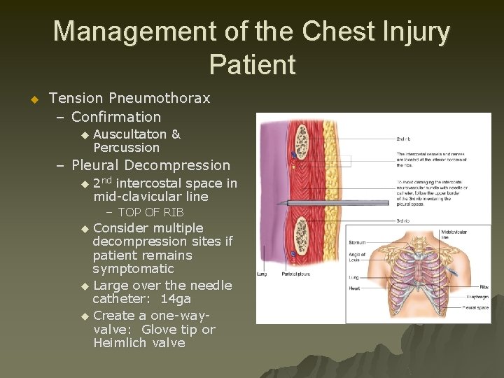 Management of the Chest Injury Patient u Tension Pneumothorax – Confirmation u Auscultaton &