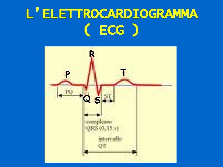 L’ELETTROCARDIOGRAMMA ( ECG ) R T P Q S 62 