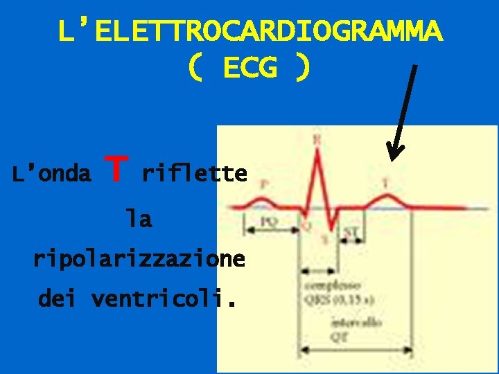 L’ELETTROCARDIOGRAMMA ( ECG ) L’onda T riflette la ripolarizzazione dei ventricoli. 