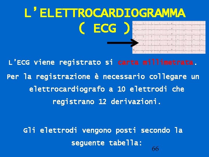 L’ELETTROCARDIOGRAMMA ( ECG ) L’ECG viene registrato si carta millimetrata. Per la registrazione è