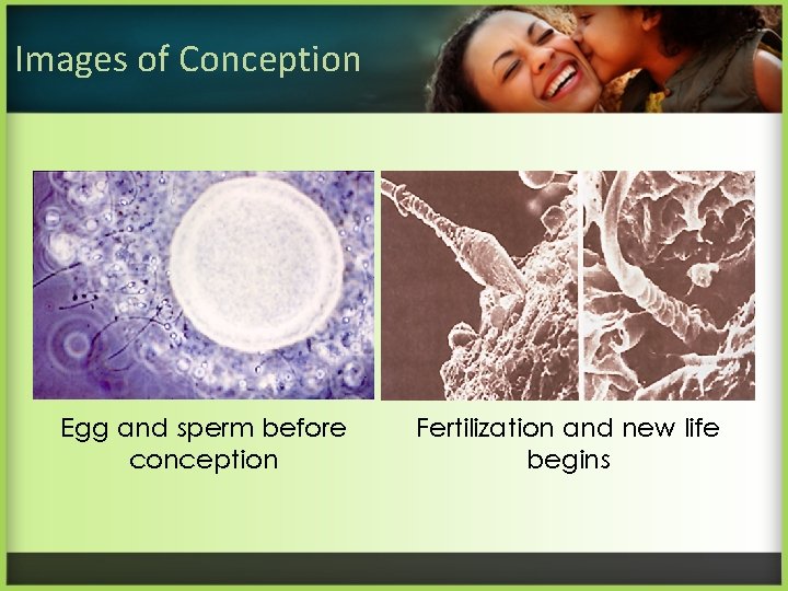Images of Conception Egg and sperm before conception Fertilization and new life begins 