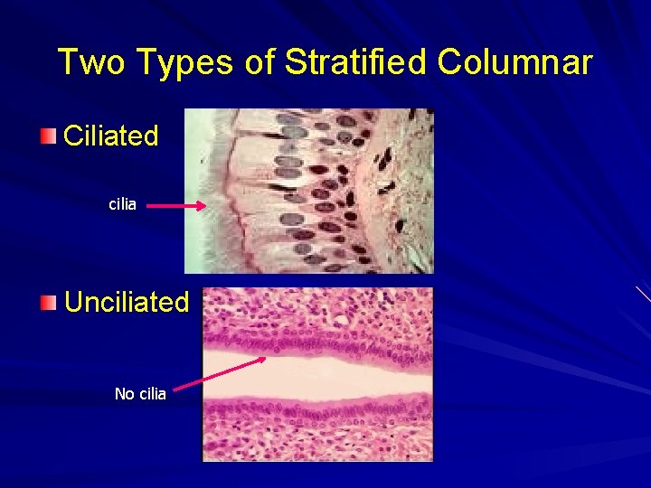 Two Types of Stratified Columnar Ciliated cilia Unciliated No cilia 