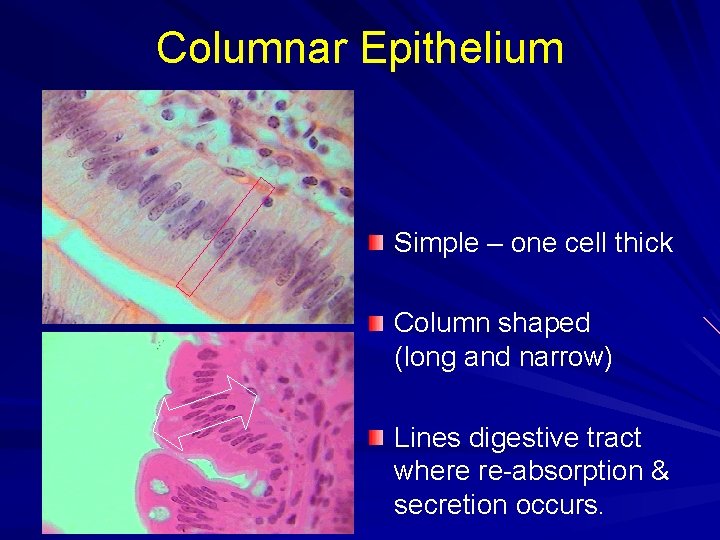 Columnar Epithelium Simple – one cell thick Column shaped (long and narrow) Lines digestive