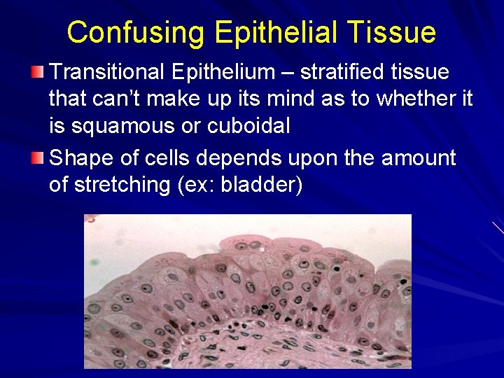 Confusing Epithelial Tissue Transitional Epithelium – stratified tissue that can’t make up its mind