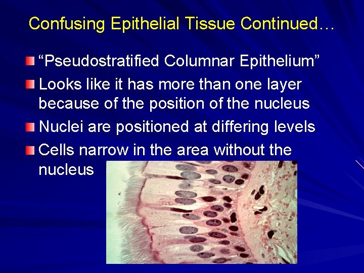 Confusing Epithelial Tissue Continued… “Pseudostratified Columnar Epithelium” Looks like it has more than one