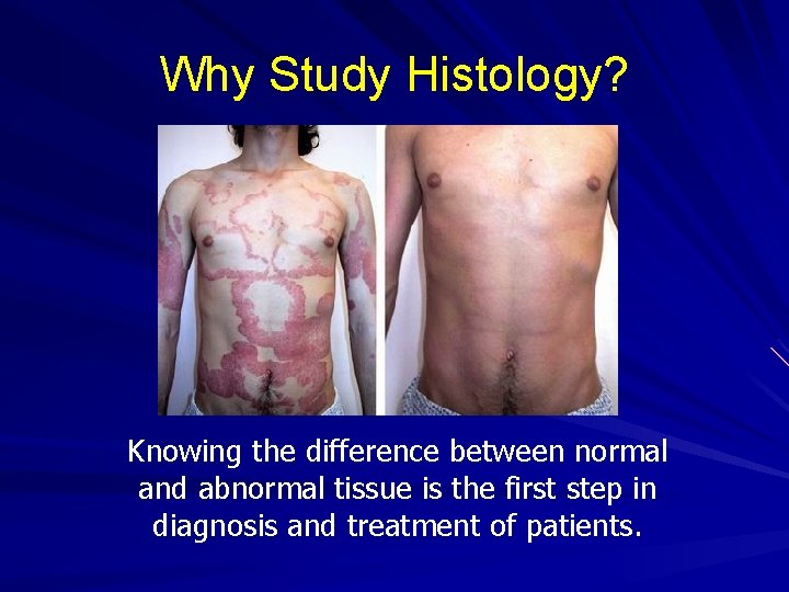 Why Study Histology? Knowing the difference between normal and abnormal tissue is the first