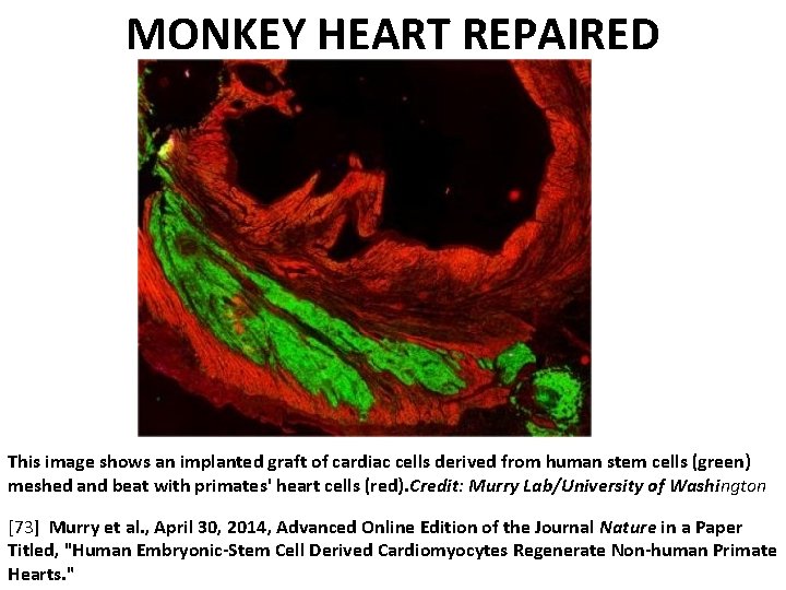 MONKEY HEART REPAIRED This image shows an implanted graft of cardiac cells derived from