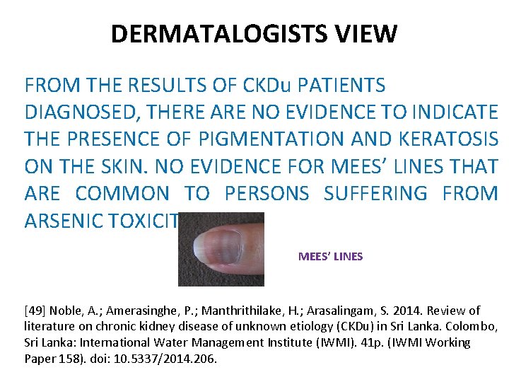 DERMATALOGISTS VIEW FROM THE RESULTS OF CKDu PATIENTS DIAGNOSED, THERE ARE NO EVIDENCE TO