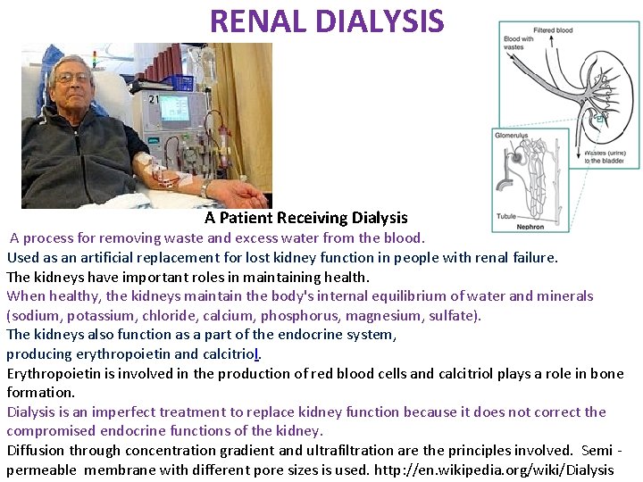 RENAL DIALYSIS A Patient Receiving Dialysis A process for removing waste and excess water