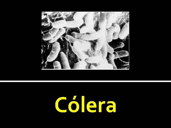 Cólera 
