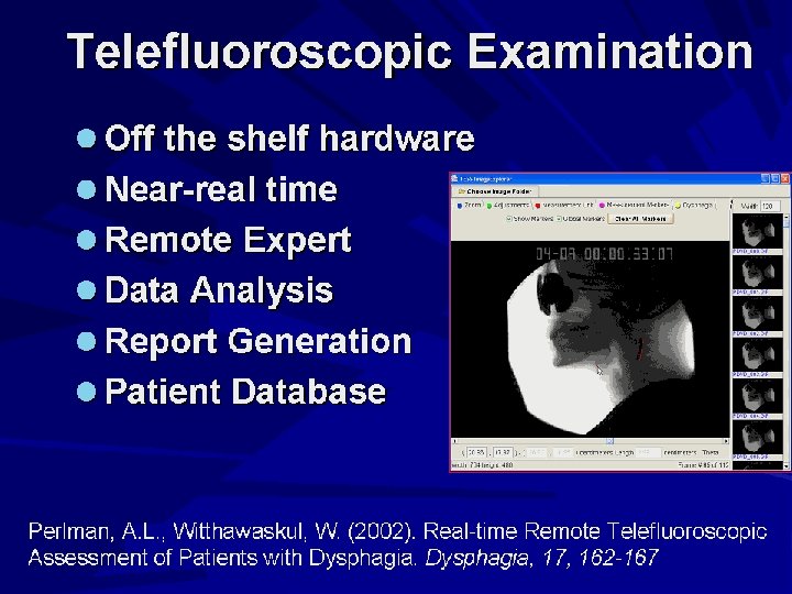 Telefluoroscopic Examination Off the shelf hardware Near-real time Remote Expert Data Analysis Report Generation