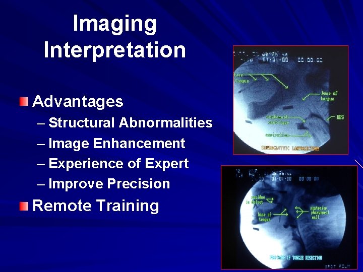Imaging Interpretation Advantages – Structural Abnormalities – Image Enhancement – Experience of Expert –