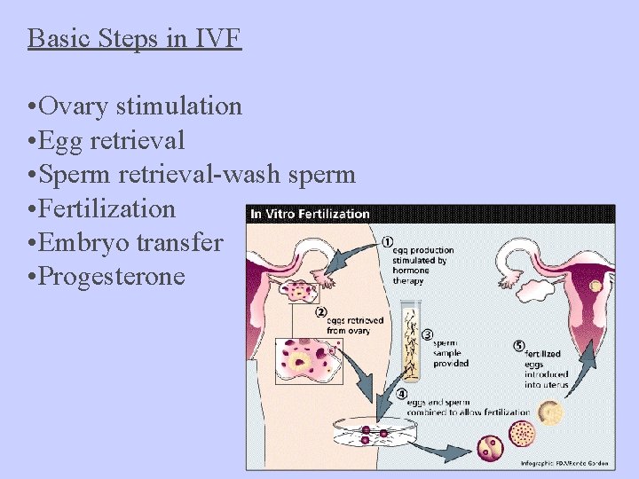 Basic Steps in IVF • Ovary stimulation • Egg retrieval • Sperm retrieval-wash sperm