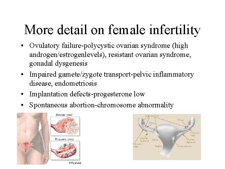 More detail on female infertility • Ovulatory failure-polycystic ovarian syndrome (high androgen/estrogenlevels), resistant ovarian