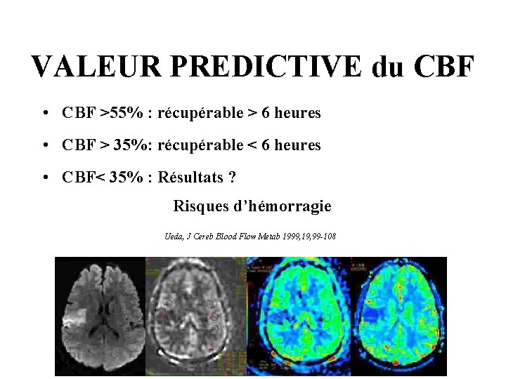 VALEUR PREDICTIVE du CBF • CBF >55% : récupérable > 6 heures • CBF