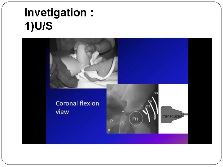 Invetigation : 1)U/S 