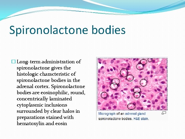 Spironolactone bodies � Long-term administration of spironolactone gives the histologic characteristic of spironolactone bodies