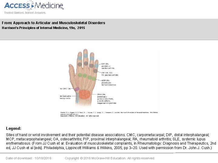 From: Approach to Articular and Musculoskeletal Disorders Harrison's Principles of Internal Medicine, 19 e,