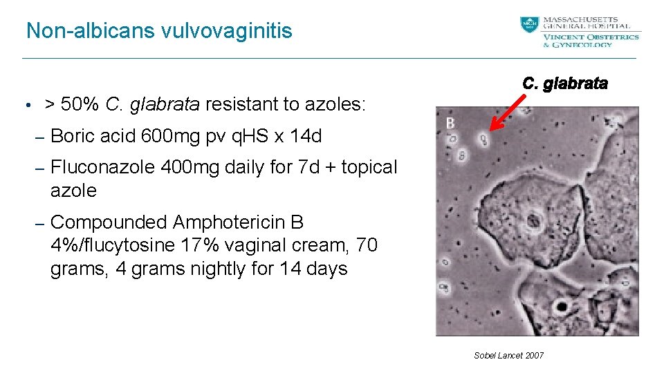 Non-albicans vulvovaginitis C. glabrata • > 50% C. glabrata resistant to azoles: – Boric