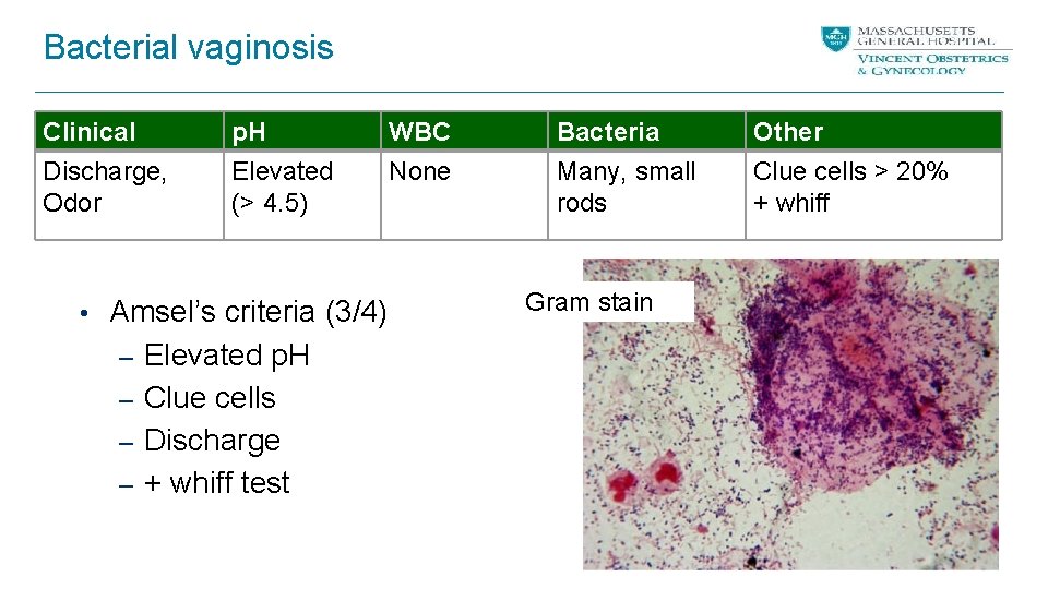 Bacterial vaginosis Clinical Discharge, Odor p. H Elevated (> 4. 5) • Amsel’s criteria