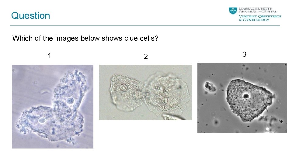 Question Which of the images below shows clue cells? 1 2 3 