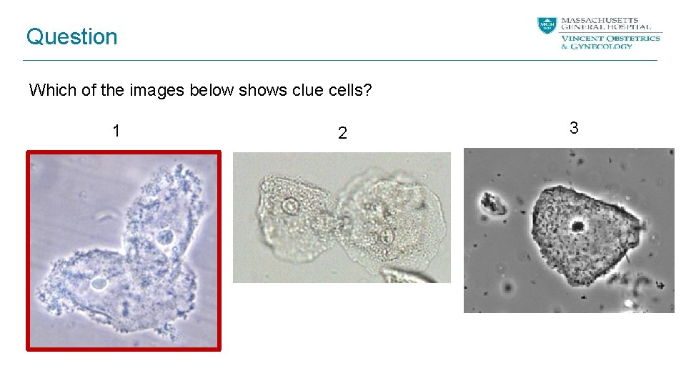 Question Which of the images below shows clue cells? 1 2 3 