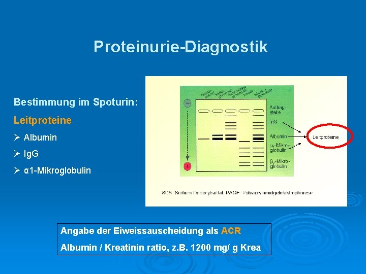 Proteinurie-Diagnostik Bestimmung im Spoturin: Leitproteine Ø Albumin Ø Ig. G Ø α 1 -Mikroglobulin