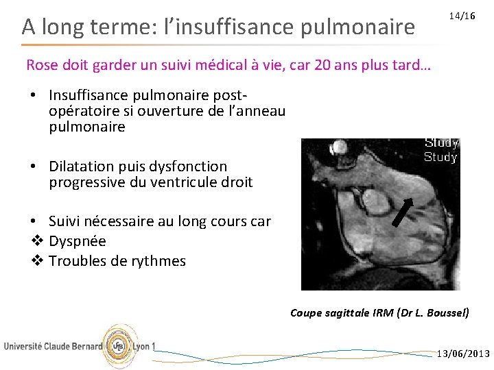 A long terme: l’insuffisance pulmonaire 14/16 Rose doit garder un suivi médical à vie,