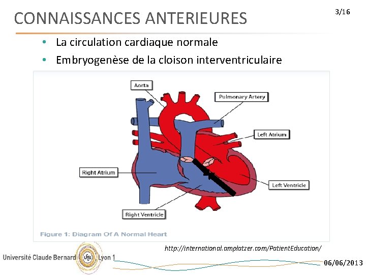 CONNAISSANCES ANTERIEURES 3/16 • La circulation cardiaque normale • Embryogenèse de la cloison interventriculaire