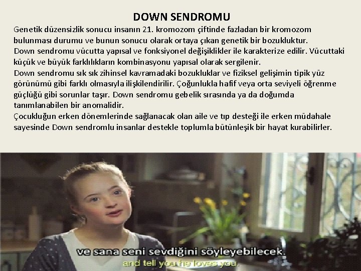 DOWN SENDROMU Genetik düzensizlik sonucu insanın 21. kromozom çiftinde fazladan bir kromozom bulunması durumu