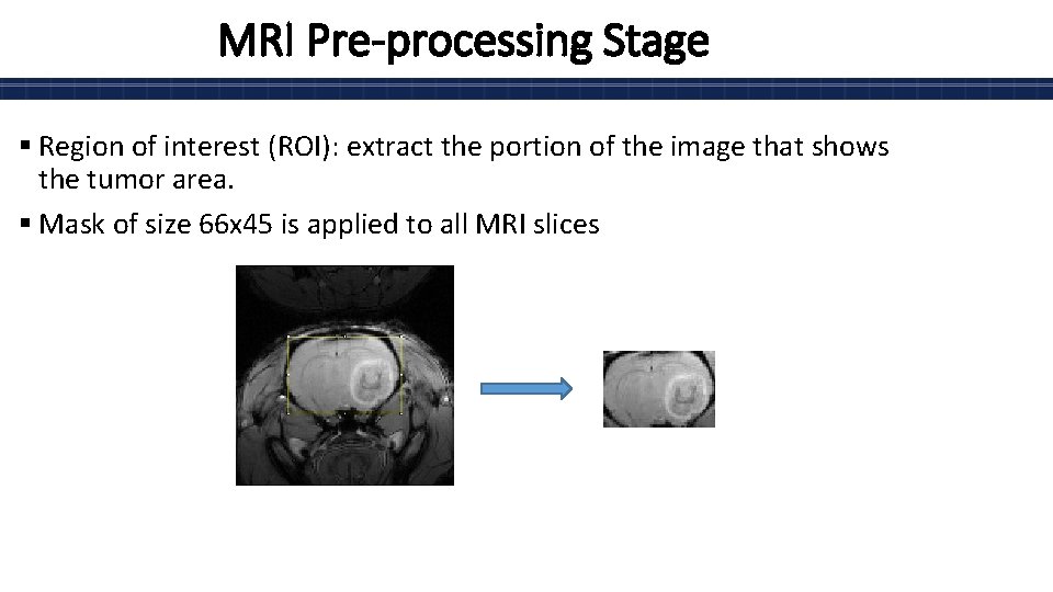 MRI Pre-processing Stage § Region of interest (ROI): extract the portion of the image
