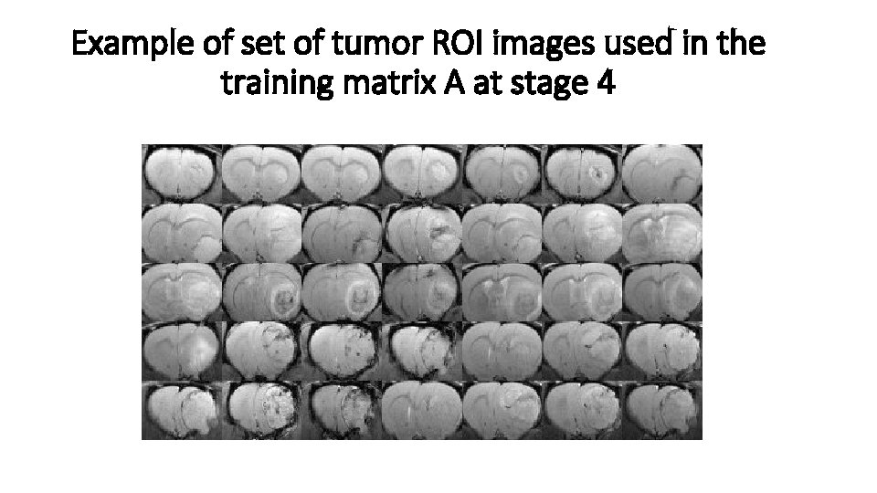 Example of set of tumor ROI images used in the training matrix A at
