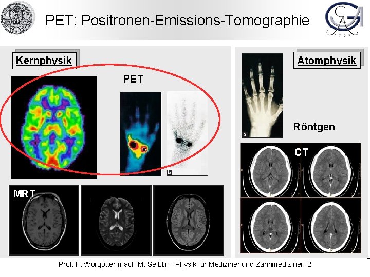 PET: Positronen-Emissions-Tomographie Atomphysik Kernphysik PET Röntgen CT MRT Prof. F. Wörgötter (nach M. Seibt)