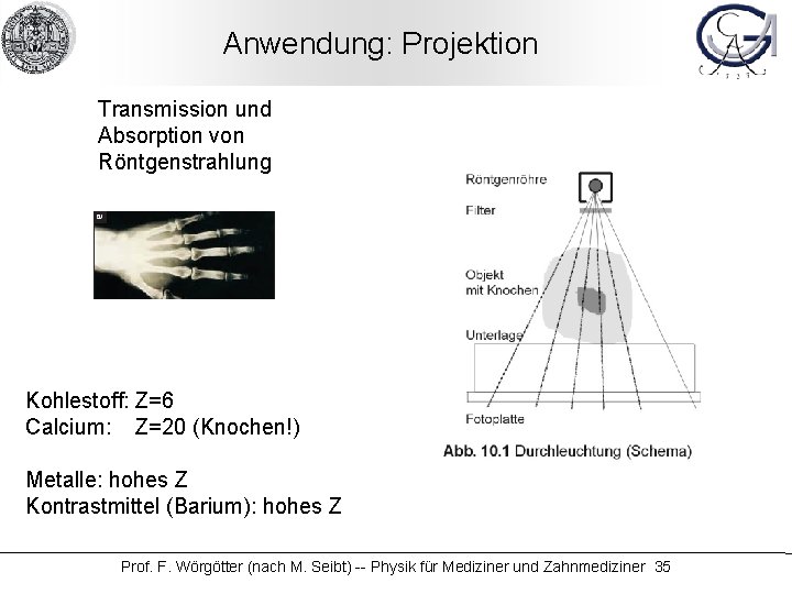 Anwendung: Projektion Transmission und Absorption von Röntgenstrahlung Kohlestoff: Z=6 Calcium: Z=20 (Knochen!) Metalle: hohes