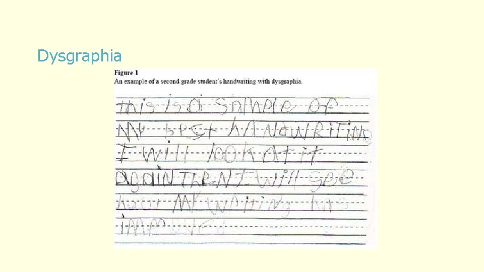 Dysgraphia 