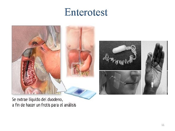 Enterotest 11 