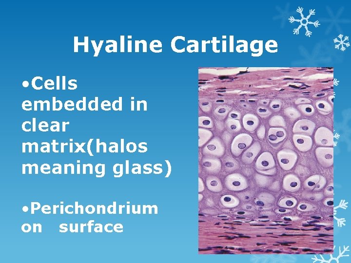 Hyaline Cartilage • Cells embedded in clear matrix(halos meaning glass) • Perichondrium on surface