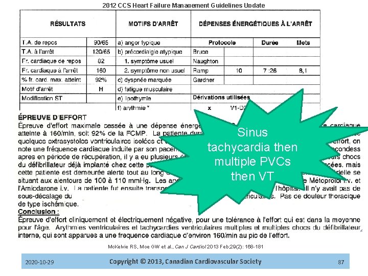 2012 CCS Heart Failure Management Guidelines Update Sinus tachycardia then multiple PVCs then VT